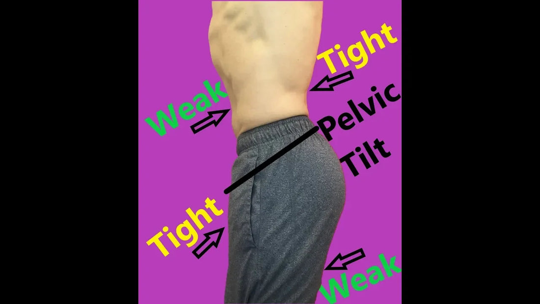 Anterior Pelvic Tilt Correction