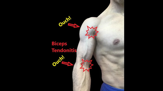 Biceps Tendonitis | Exercises For Myofascial Pain